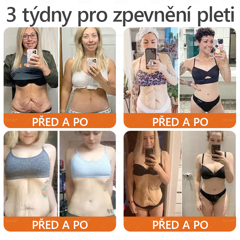 📅Doporučení dermatologa 🐝 ✨Sinvie® Krém na obnovu pleti s včelím jedem 🔥 Český vývoj, výroba a dodávka v České republice