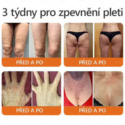 📅Doporučení dermatologa 🐝 ✨Sinvie® Krém na obnovu pleti s včelím jedem 🔥 Český vývoj, výroba a dodávka v České republice