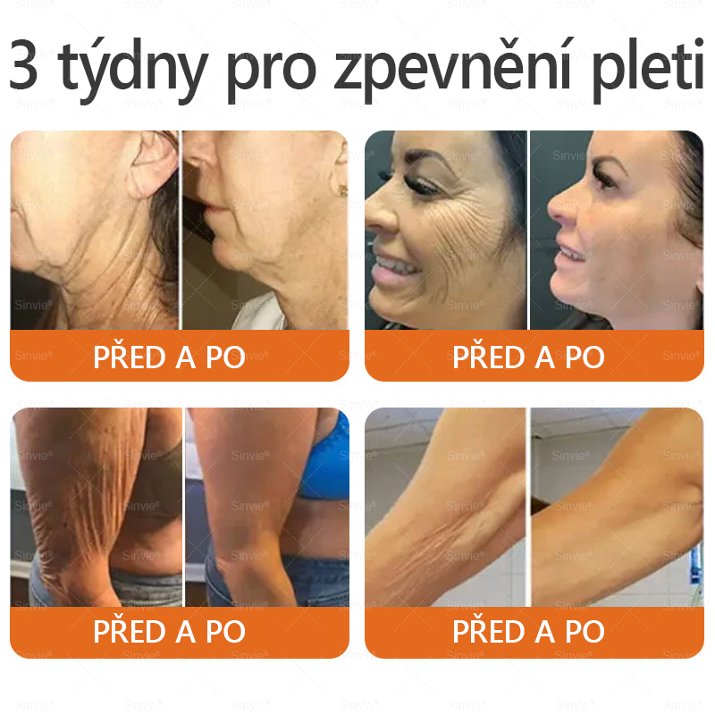 📅Doporučení dermatologa 🐝 ✨Sinvie® Krém na obnovu pleti s včelím jedem 🔥 Český vývoj, výroba a dodávka v České republice