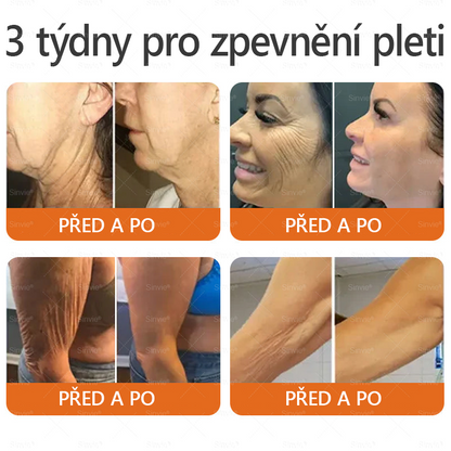 📅Doporučení dermatologa 🐝 ✨Sinvie® Krém na obnovu pleti s včelím jedem 🔥 Český vývoj, výroba a dodávka v České republice