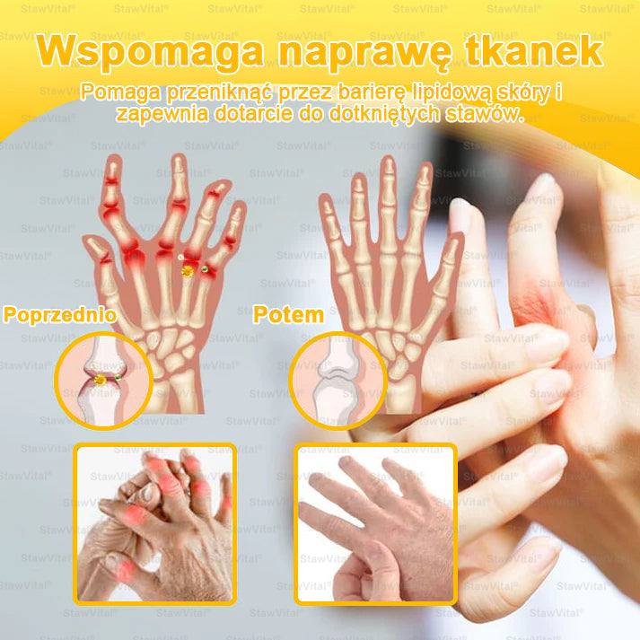 BSWELL® Krem z jadem pszczelim na regenerację stawów 🏃‍♀️ (ekstrakt z pszczoły nowozelandzkiej – opracowany z myślą o osobach z problemami ze stawami i bólem stawów)