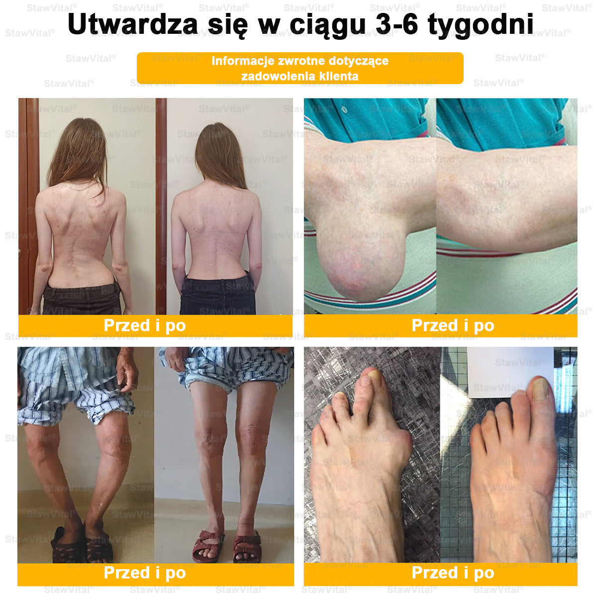 BSWELL® Krem z jadem pszczelim na regenerację stawów 🏃‍♀️ (ekstrakt z pszczoły nowozelandzkiej – opracowany z myślą o osobach z problemami ze stawami i bólem stawów)