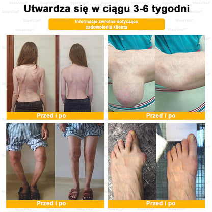 BSWELL® Krem z jadem pszczelim na regenerację stawów 🏃‍♀️ (ekstrakt z pszczoły nowozelandzkiej – opracowany z myślą o osobach z problemami ze stawami i bólem stawów)