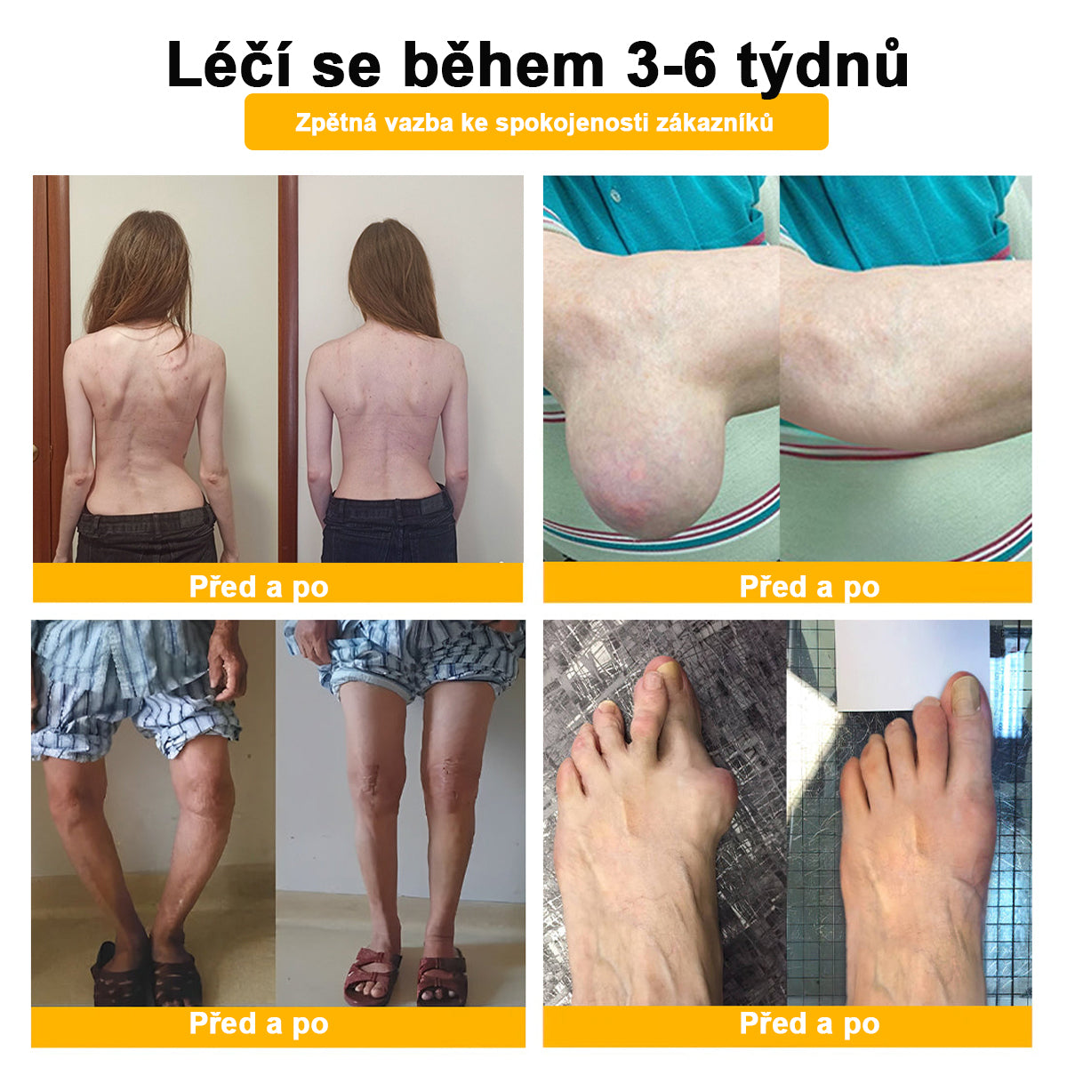 ✅BSWELL® krém s včelím jedem pro regeneraci kloubů 🏃‍♀️ (extrakt z novozélandských včel – vyvinutý speciálně pro lidi s problémy s klouby a bolestí kloubů)