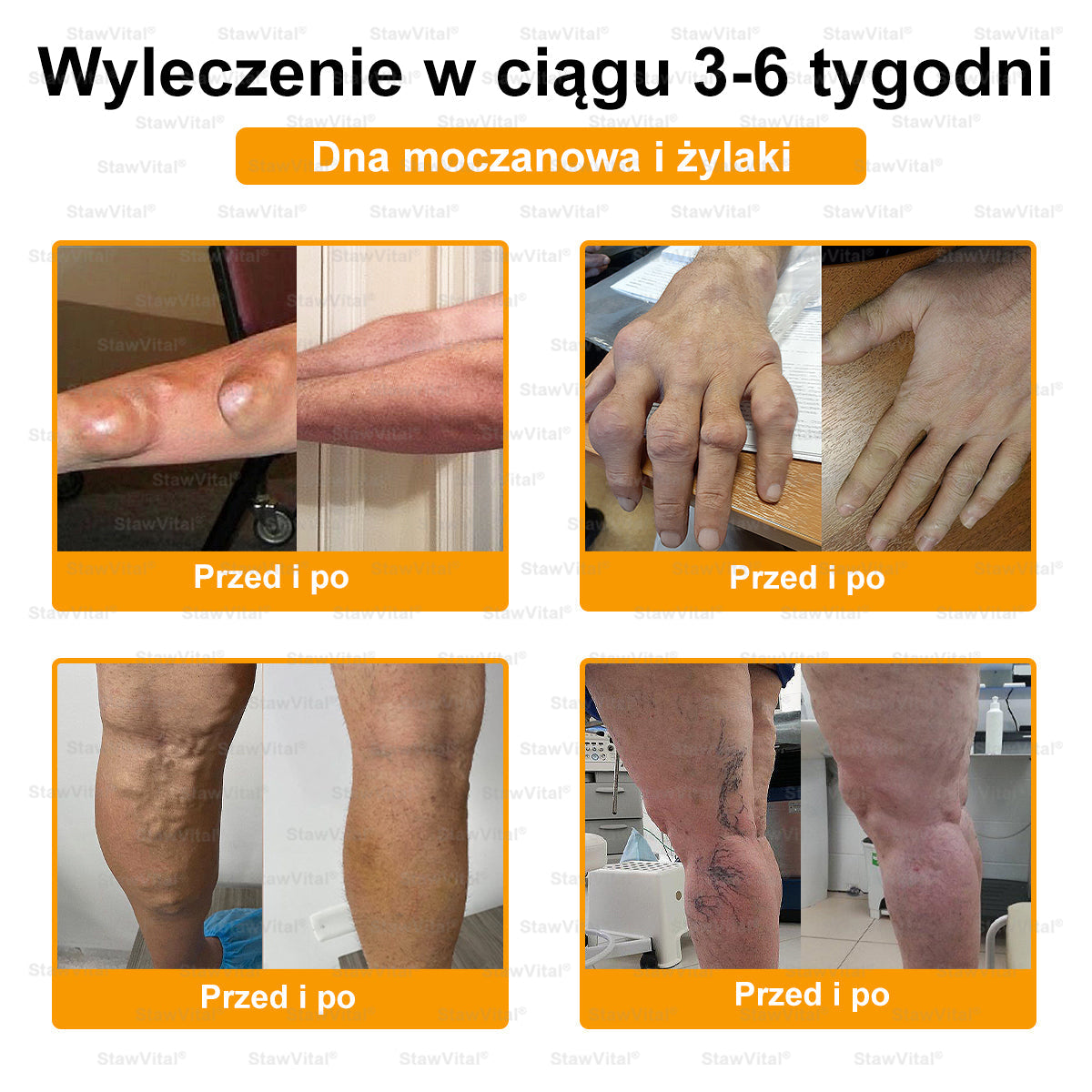BSWELL® Krem z jadem pszczelim na regenerację stawów 🏃‍♀️ (ekstrakt z pszczoły nowozelandzkiej – opracowany z myślą o osobach z problemami ze stawami i bólem stawów)