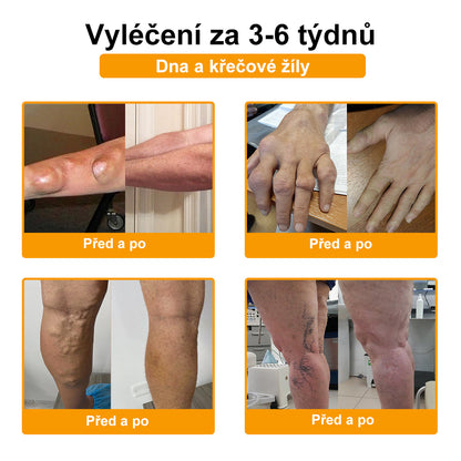 ✅BSWELL® krém s včelím jedem pro regeneraci kloubů 🏃‍♀️ (extrakt z novozélandských včel – vyvinutý speciálně pro lidi s problémy s klouby a bolestí kloubů)