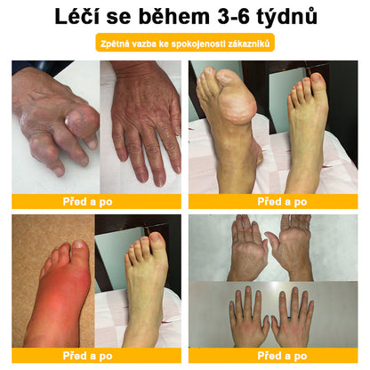 ✅BSWELL® krém s včelím jedem pro regeneraci kloubů 🏃‍♀️ (extrakt z novozélandských včel – vyvinutý speciálně pro lidi s problémy s klouby a bolestí kloubů)