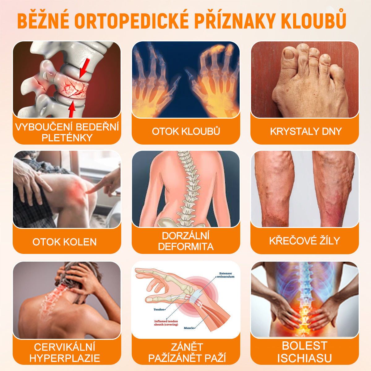 ✅BSWELL® krém s včelím jedem pro regeneraci kloubů 🏃‍♀️ (extrakt z novozélandských včel – vyvinutý speciálně pro lidi s problémy s klouby a bolestí kloubů)