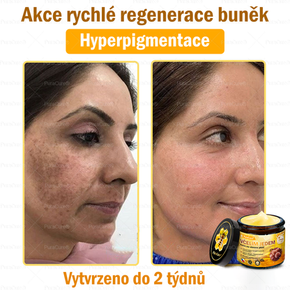 ✔️Doporučení dermatologa 🐝 ✨PuraCure® Krém na obnovu pleti s včelím jedem 🔥 Český vývoj, výroba a dodávka v České republice