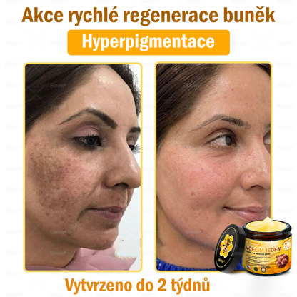 📅Doporučení dermatologa 🐝 ✨Sinvie® Krém na obnovu pleti s včelím jedem 🔥 Český vývoj, výroba a dodávka v České republice