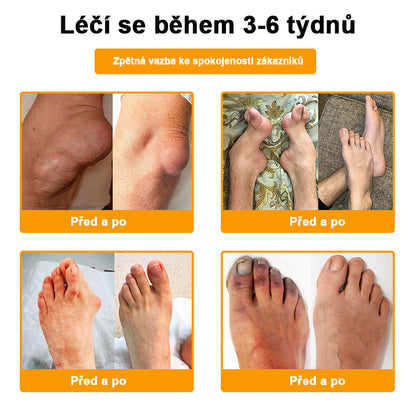✅BSWELL® krém s včelím jedem pro regeneraci kloubů 🏃‍♀️ (extrakt z novozélandských včel – vyvinutý speciálně pro lidi s problémy s klouby a bolestí kloubů)