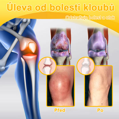 ✅BSWELL® krém s včelím jedem pro regeneraci kloubů 🏃‍♀️ (extrakt z novozélandských včel – vyvinutý speciálně pro lidi s problémy s klouby a bolestí kloubů)