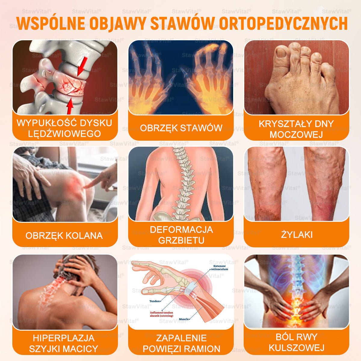 BSWELL® Krem z jadem pszczelim na regenerację stawów 🏃‍♀️ (ekstrakt z pszczoły nowozelandzkiej – opracowany z myślą o osobach z problemami ze stawami i bólem stawów)