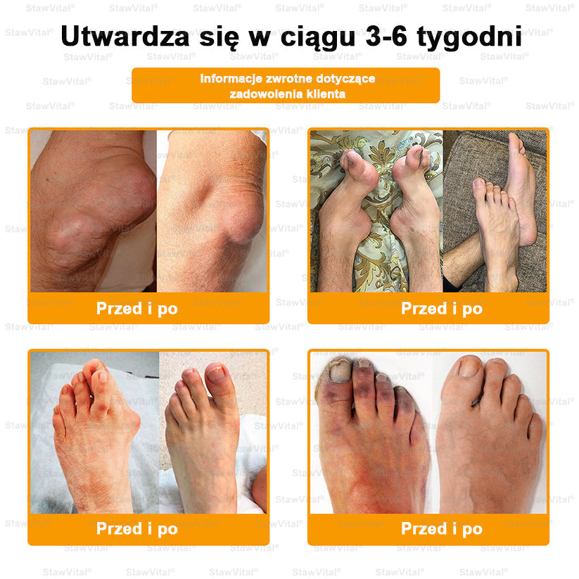 BSWELL® Krem z jadem pszczelim na regenerację stawów 🏃‍♀️ (ekstrakt z pszczoły nowozelandzkiej – opracowany z myślą o osobach z problemami ze stawami i bólem stawów)