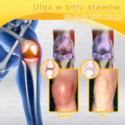 BSWELL® Krem z jadem pszczelim na regenerację stawów 🏃‍♀️ (ekstrakt z pszczoły nowozelandzkiej – opracowany z myślą o osobach z problemami ze stawami i bólem stawów)